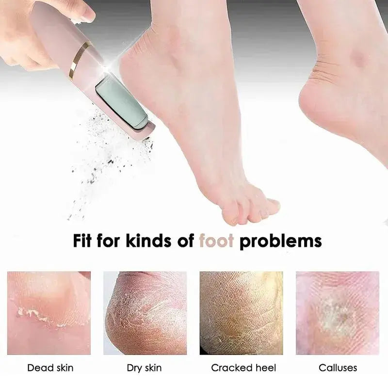 Electric Foot Callus Remover and Pedicure Grinder - Genmarty