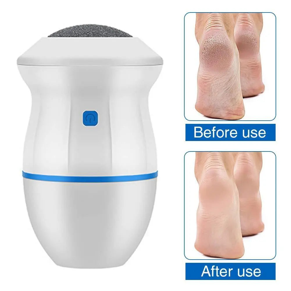 Electric Callus Remover with Built-In Vacuum & Foot Grinder Head - Genmarty