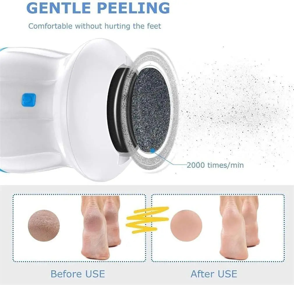 Electric Callus Remover with Built-In Vacuum & Foot Grinder Head - Genmarty